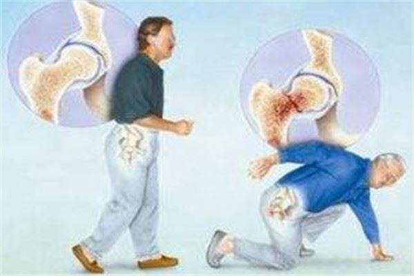 世界最难治的十大慢性病，慢性腰痛排名第一